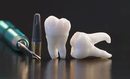 做梦梦到掉牙是什么意思